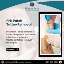 PFD Patch Tattoo Removal: Advanced & Effective Solution