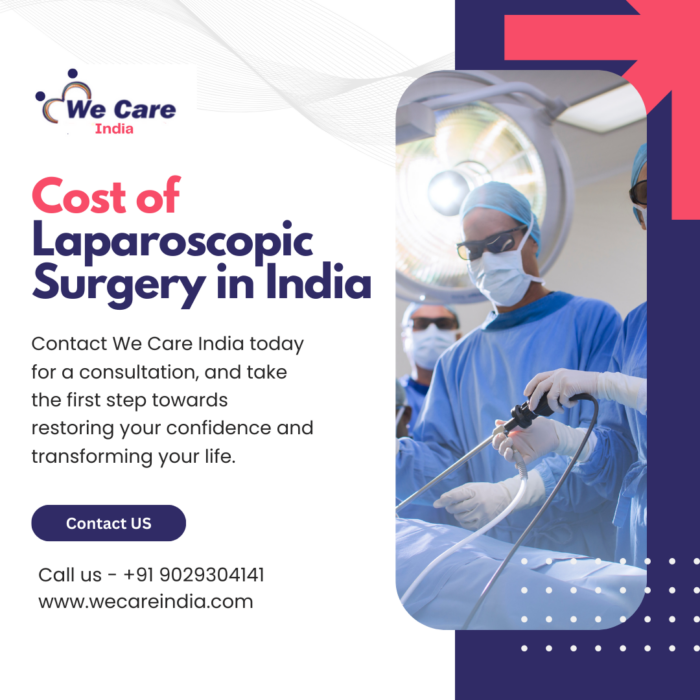 Cost of Laparoscopic Surgery in India
