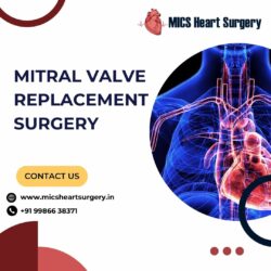 Mitral Valve Replacement Surgery Bangalore | MICS Cost