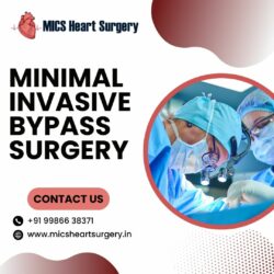 Minimally Invasive Bypass (MIDCAB) Surgery Bangalore