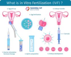 What is IVF?