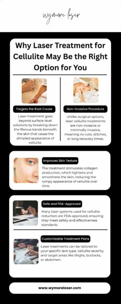 Wymore Laser Offers the Best Laser Treatment for Cellulite