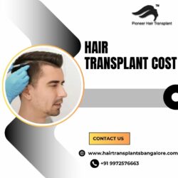 Hair Transplant Clinics in Bangalore | Hair Transplant Cost