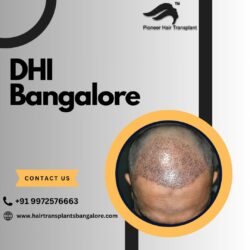 DHT Hair Transplant Bangalore | DHI Hair Transplant Cost