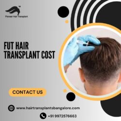 Best FUE Hair Transplant in Bangalore | FUE Hair Transplant Cost