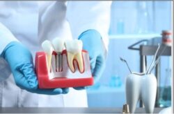 Dental Crowns Penrith