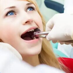 Wisdom Teeth Removal Penrith