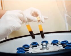 Prf Treatment For Face in Center Moriches