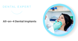 What are All-on-4 Dental Implants?