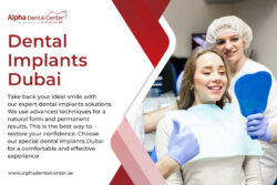 Get a Confident Smile with Dental Implants Dubai