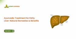 Ayurvedic Treatment for Fatty Liver: Natural Remedies & Benefits