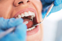 What Are the Best Marketing Ideas for Dental Clinics?