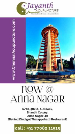 Acupuncture Treatment in Anna Nagar – Chennai