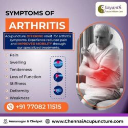 Acupuncture Treatment for Arthritis – Knee Pain – Joint Pain in Chennai