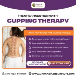 Cupping Therapy in Anna Nagar | Cupping Specialist Near Me in Chennai