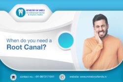 Best Dental Implants in Gurgaon – Ministry of Smile