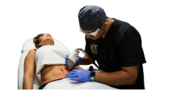 Scar Removal Lake Worth Fl Focused on Skin Renewal and Balance