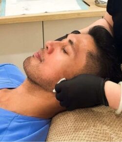 Microneedling Double Bay