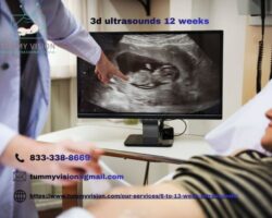 3D Ultrasound 12 Weeks Early Baby Peek