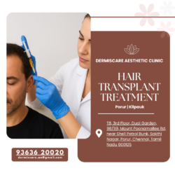Hair Transplant Treatment