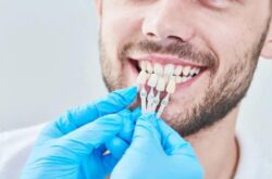 Dental implants alfred cove