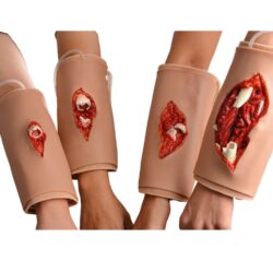 Wearable Open Fracture Wound Care Trainer – Type II, IIIA-IIIC
